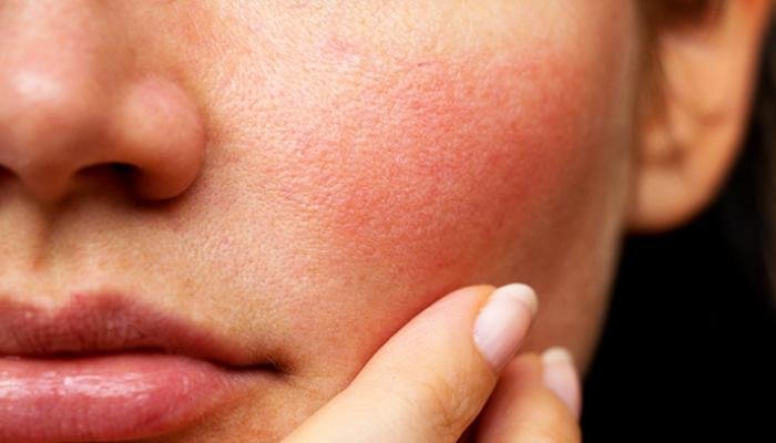 كيفية العناية بالبشرة وتبيضها خاصًة الحساسة